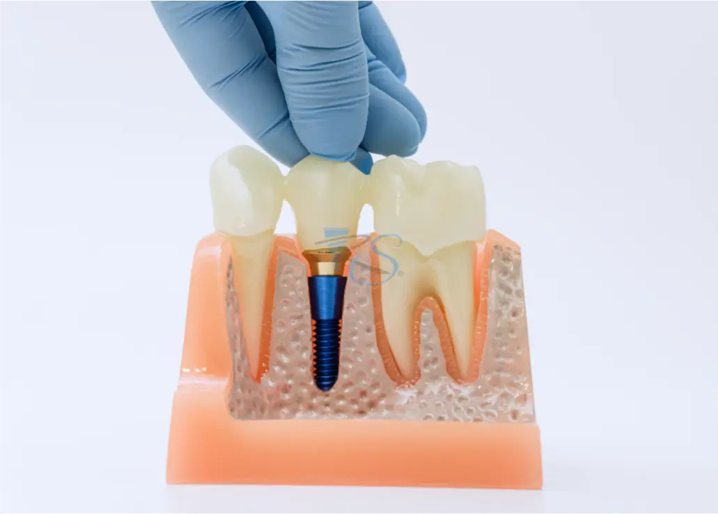 practical implant ce course for dentists