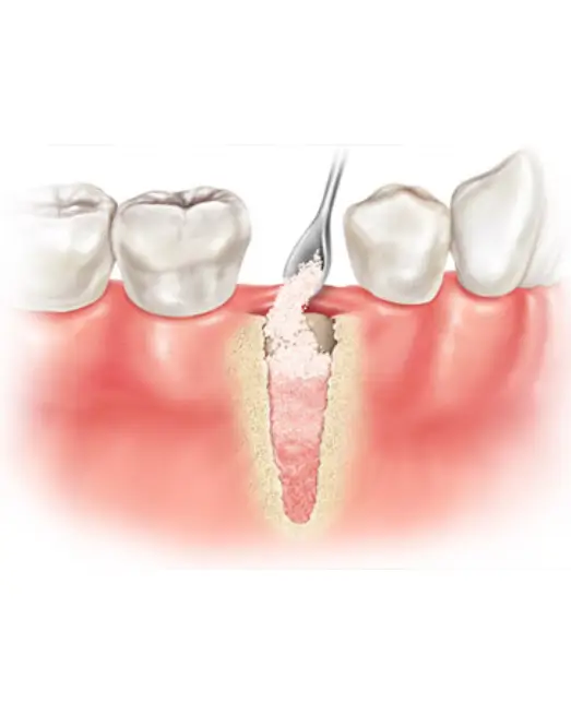 Implant Seminars details